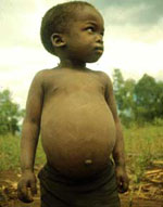 World Food Program warns the UN that a record 38 million people are at risk of starvation in Africa