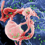 The first recognised AIDS cases are reported in the USA
